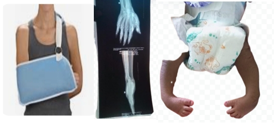 Orthopedic consultation