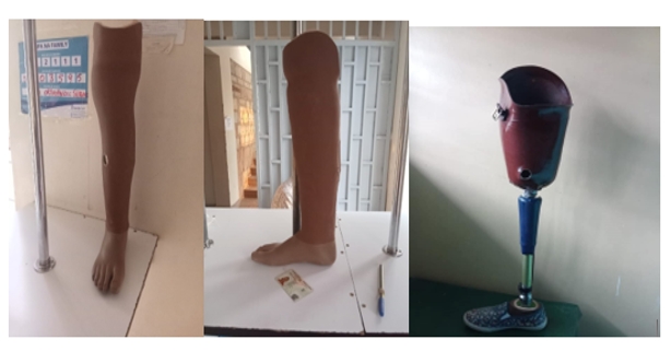 Custom orthopedic devices at ROMA