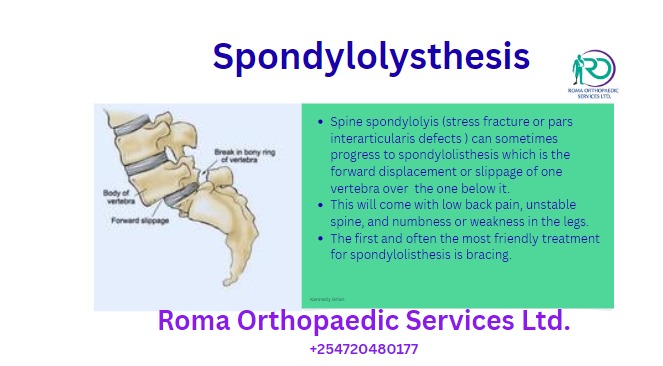 ROMA Orthopaedic Services team
